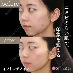渋谷美容外科クリニック 新宿院の症例