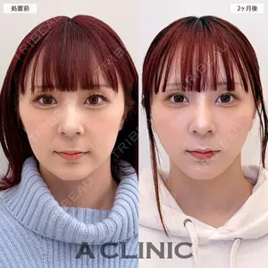 A CLINIC（エークリニック） 大阪院 田窪 賢志郎医師の症例