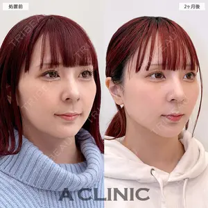 A CLINIC（エークリニック） 大阪院 田窪 賢志郎医師の症例