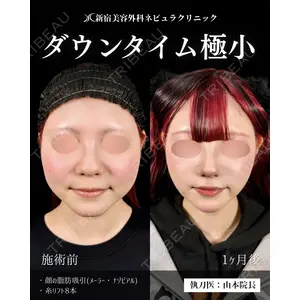 新宿美容外科ネビュラクリニック 山本 紘子医師の症例