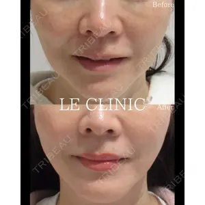 LE CLINICの症例