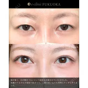 eクリニック 福岡院 伊藤 渉医師の症例