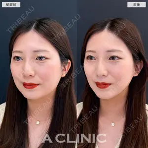 A CLINIC（エークリニック） 大阪院 田窪 賢志郎医師の症例