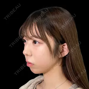 PRISM Beauty Clinic 新宿院 畑山 知輝医師の症例