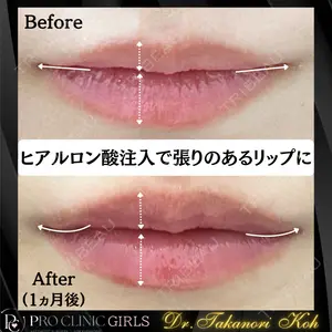 PRO CLINIC プロクリニック 銀座院 洪 嵩典医師の症例
