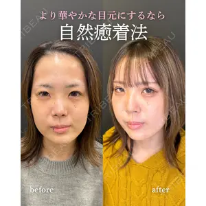 ルラ美容クリニック 岐阜院 馬場 愛理医師の症例