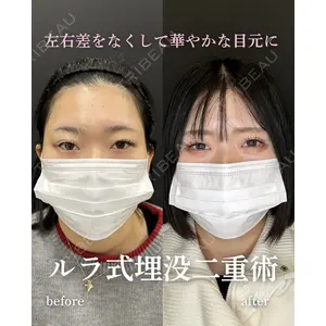 ルラ美容クリニック 岐阜院 馬場 愛理医師の症例