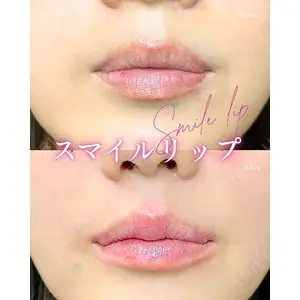 ルラ美容クリニック 岐阜院 馬場 愛理医師の症例