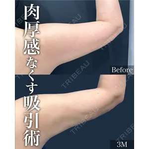 湘南美容クリニック 神戸三宮院 河上 帆乃佳医師の症例