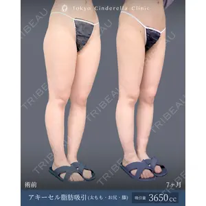 東京シンデレラ美容外科 新宿院 吉原 伯医師の症例