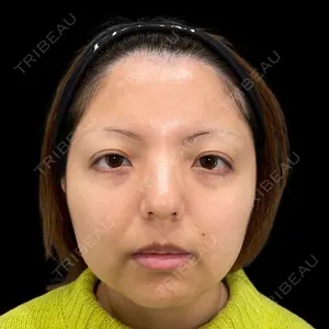 PRISM Beauty Clinic 新宿院 畑山 知輝医師の症例