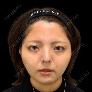 PRISM Beauty Clinic 新宿院 畑山 知輝医師の症例