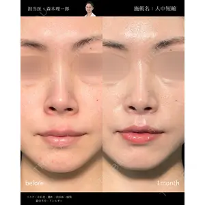 PRISM Beauty Clinic 町田院 森本 理一郎医師の症例