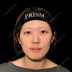 PRISM Beauty Clinic 新宿院 畑山 知輝医師の症例