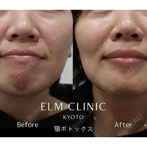 美容皮膚科エルムクリニック 京都院 内山 雄一朗医師の症例
