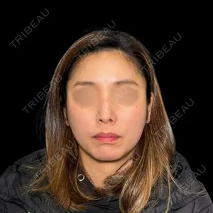 PRISM Beauty Clinic 新宿院 畑山 知輝医師の症例
