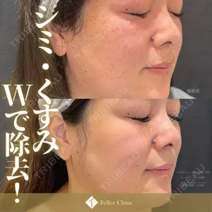 Fellez Clinic【フェルズクリニック】の症例