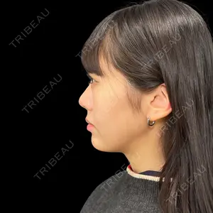 PRISM Beauty Clinic 新宿院 畑山 知輝医師の症例