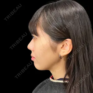 PRISM Beauty Clinic 新宿院 畑山 知輝医師の症例