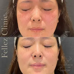 Fellez Clinic【フェルズクリニック】の症例