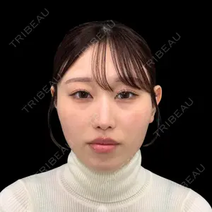 PRISM Beauty Clinic 新宿院 畑山 知輝医師の症例