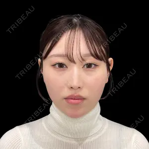 PRISM Beauty Clinic 新宿院 畑山 知輝医師の症例
