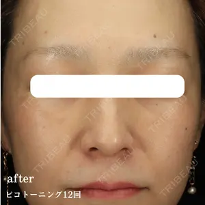 東京美容皮膚科アロエクリニック池袋東口院 黄 責詮医師の症例