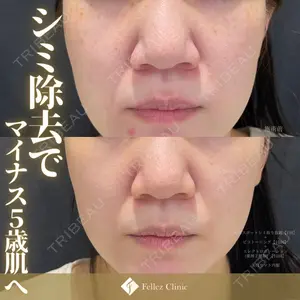 Fellez Clinic【フェルズクリニック】の症例