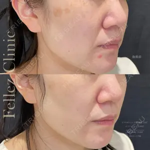 Fellez Clinic【フェルズクリニック】の症例