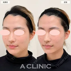 A CLINIC（エークリニック） 大阪院 田窪 賢志郎医師の症例