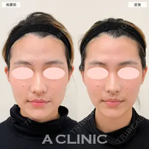 A CLINIC（エークリニック） 大阪院 田窪 賢志郎医師の症例