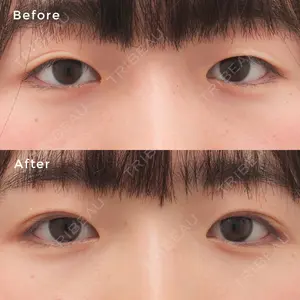 東京イセアクリニック 権東　容秀医師の症例