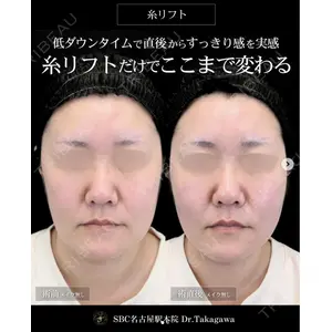 湘南美容クリニック 名古屋駅本院 高川 裕也医師の症例