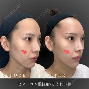 BiBiクリニック 山本 幸一郎医師の症例