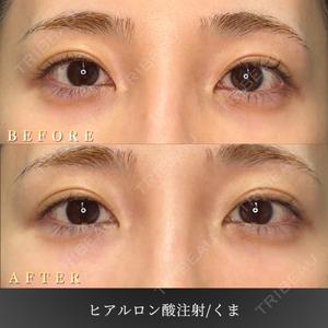BiBiクリニック 山本 幸一郎医師の症例