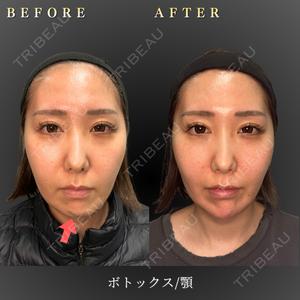 BiBiクリニック 山本 幸一郎医師の症例