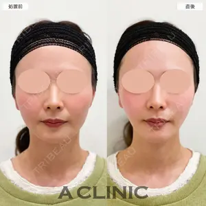 A CLINIC（エークリニック） 大阪院 田窪 賢志郎医師の症例