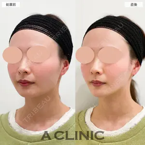 A CLINIC（エークリニック） 大阪院 田窪 賢志郎医師の症例