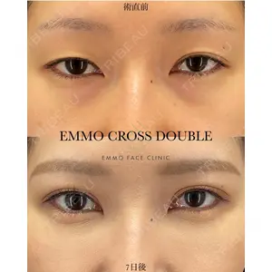 EMMO FACE CLINIC 大宮院 廣松 直樹医師の症例