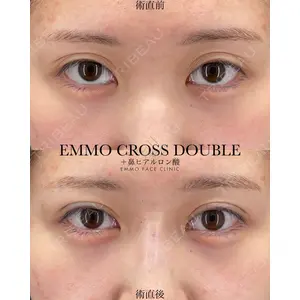 EMMO FACE CLINIC 大宮院 廣松 直樹医師の症例