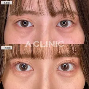 A CLINIC（エークリニック） 大阪院 田窪 賢志郎医師の症例