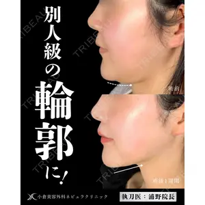 小倉美容外科ネビュラクリニック 浦野 正樹医師の症例