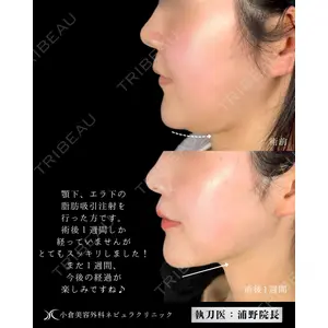 小倉美容外科ネビュラクリニック 浦野 正樹医師の症例