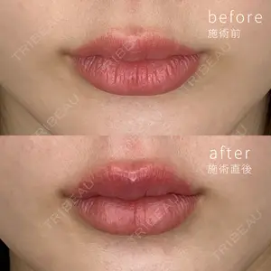 ミニマムスキンクリニック銀座の症例