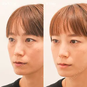 東京イセアクリニック 権東　容秀医師の症例