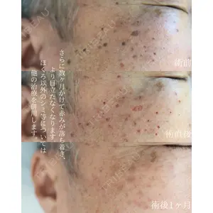 小暮整形外科・美容外科の症例