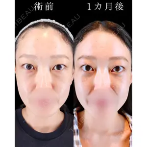 HAAB BEAUTY CLINIC 南青山本院（新院） 小平 佳典医師の症例