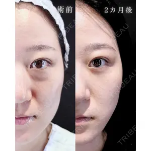 HAAB BEAUTY CLINIC 南青山本院（新院） 小平 佳典医師の症例