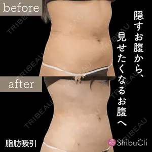 渋谷美容外科クリニック 新宿院の症例