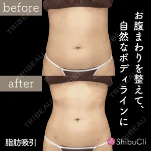 渋谷美容外科クリニック 新宿院の症例